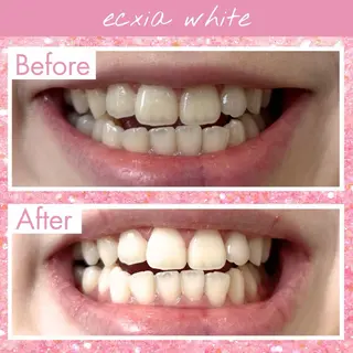 セルフホワイトニング エクシア町田店のその他イメージ