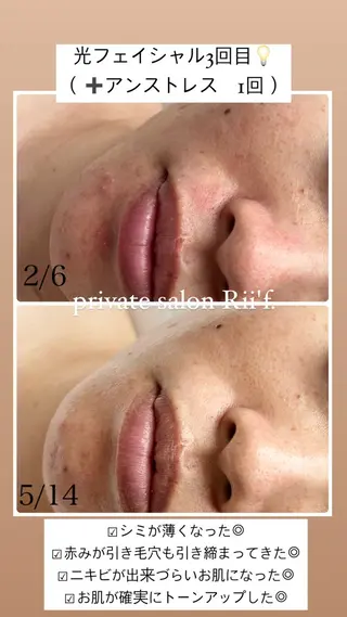 private salon Rii'f.所属・private sa lon Rii'f.のエステ・リラクイメージ