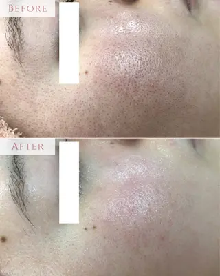 肌質改善専門サロン Bellmi/心斎橋のエステ・リラクイメージ