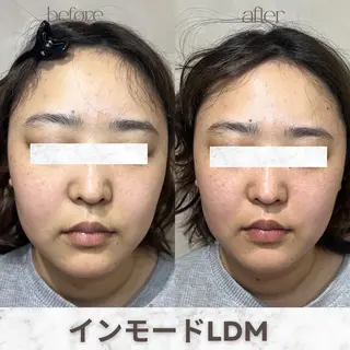 aimer 服部のその他イメージ