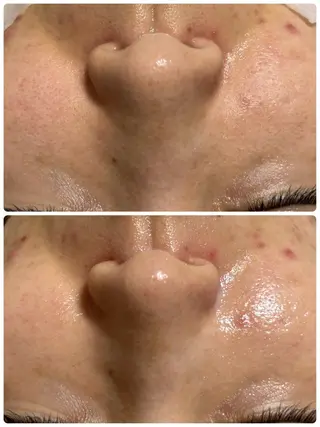 フェイシャルサロン CHIARA　美月のエステ・リラクイメージ