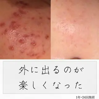 ニキビ経験者が施術 する専門サロン🌻のエステ・リラクイメージ