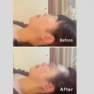 小顔＆肌質改善 NICORIのエステ・リラクイメージ