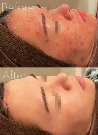 Belle栄店所属・韓国肌管理 Belle栄店のエステ・リラクイメージ