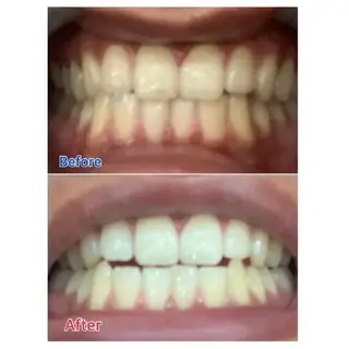 M渋谷 ホワイトニングのエステ・リラクイメージ