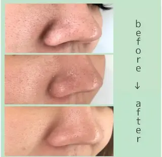 POLA御器所店 かわいれなのエステ・リラクイメージ