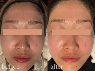 Erika komorebi_のエステ・リラクイメージ