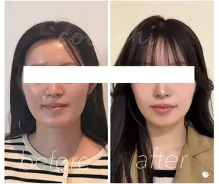 小顔と ヘッドスパのお店のエステ・リラクイメージ