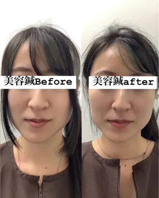 美容鍼灸×小顔整体♡ ハリサロンドオフ堺東のその他イメージ