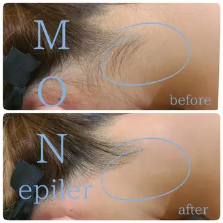 モン エピレなんば店のエステ・リラクイメージ