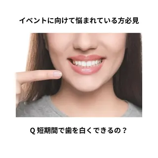 ホワイトニング ショップ津店のその他イメージ