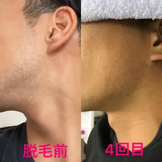 メンズ メンズ脱毛サロン ／金山昌弘のエステ・リラクイメージ