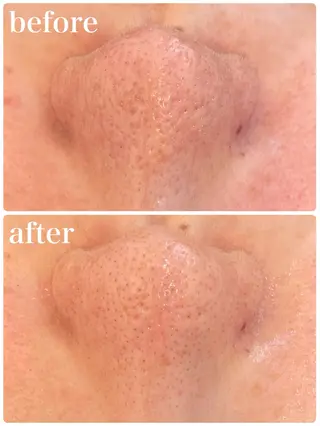 パーソナルスキンケア 🦋APRI🅿️有のエステ・リラクイメージ