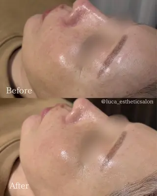 Luca 痩身• 疲労改善×韓国肌管理のエステ・リラクイメージ