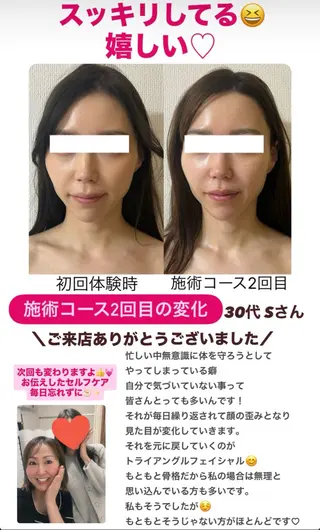 la lumie're (ラ リュミエール)所属・小顔サロン (ラ リュミエール)のエステ・リラクイメージ