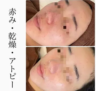 ハーブピーリング専門 BIOPLUS+川崎のエステ・リラクイメージ