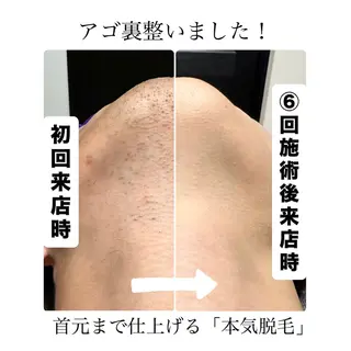 メンズ メンズ脱毛サロン Le falcoのエステ・リラクイメージ