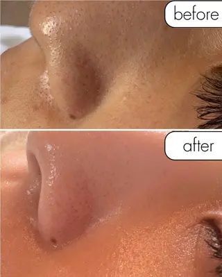 蝶式糸除毛専門salon aco所属・糸除毛専門salon acoのエステ・リラクイメージ