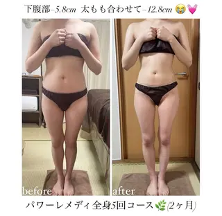 《本気痩せ×疲労改善 》  BILOOPのエステ・リラクイメージ