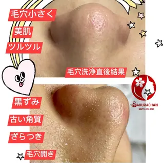 美肌，美ボディ，脱毛 サクラチャンスパのエステ・リラクイメージ