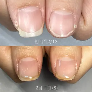 ネイル Aim* 深爪自爪育成専門店のネイルデザイン