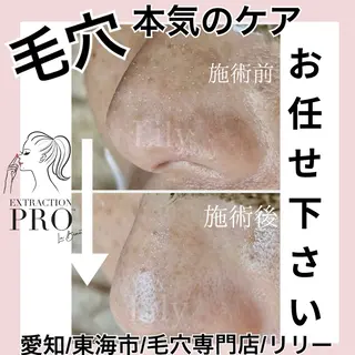 トータルビューティー サロンLilyのエステ・リラクイメージ