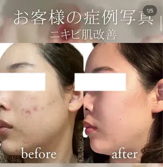 cpsalon ÉTOILE横浜馬車道店所属・ÉTOILE NATSUMIのエステ・リラクイメージ