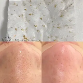 Le'perle。所属・Le'perle。 Kyokaのエステ・リラクイメージ