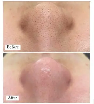 Remy♡ 石井澪菜のエステ・リラクイメージ