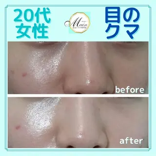 目元エステ専門店  Main(メイン)所属・Main 高野のエステ・リラクイメージ