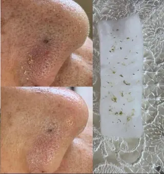 毛穴/毛穴洗浄専門 エミルカ船橋のエステ・リラクイメージ