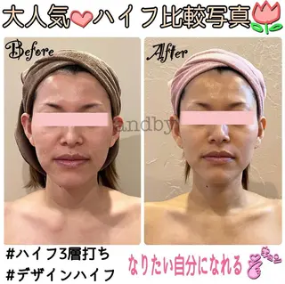 &. BYのエステ・リラクイメージ