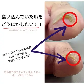 ネイル Belulu ベルルのネイルデザイン