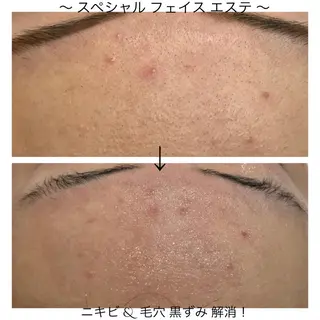 ビューティー ミロワールのエステ・リラクイメージ