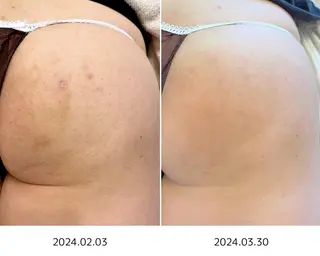 肌質改善🌿 彩也乃のエステ・リラクイメージ