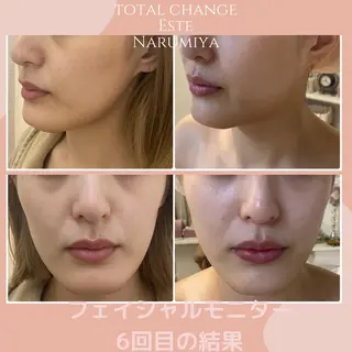 辻 佐耶のエステ・リラクイメージ