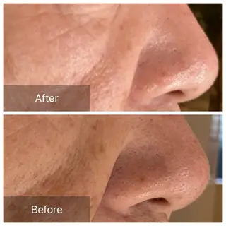 美肌エイジングケアサロンIB所属・IB 内藤のエステ・リラクイメージ