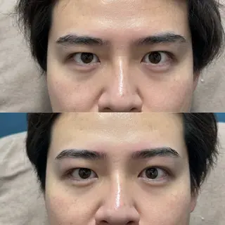 アイブロウ 男眉salon On Fleek!銀座店所属・鈴木 真奈の眉毛・アイブロウイメージ