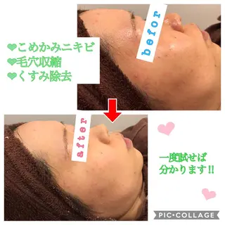 セミロング カラー パーマ ヘアアレンジ メンズ キッズ ネイル マツエク・マツパ 金の糸脱毛 産毛ケア専門のエステ・リラクイメージ