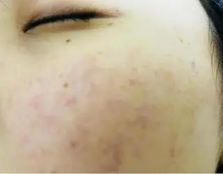 内山 なみのエステ・リラクイメージ