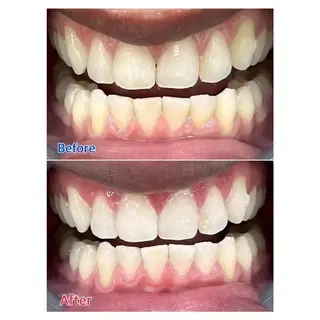 Ｍ渋谷 ホワイトニングのエステ・リラクイメージ