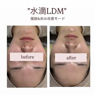 crescent所属・【韓国肌管理・脱毛】 クレセントのその他イメージ