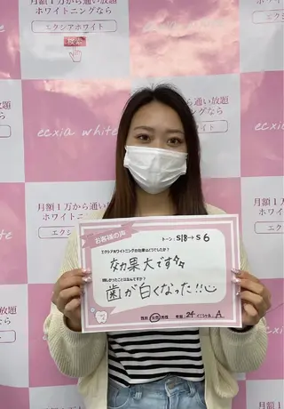 セルフホワイトニング エクシアエミフル店のその他イメージ