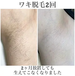 エステサロン Mi-mi.iのエステ・リラクイメージ