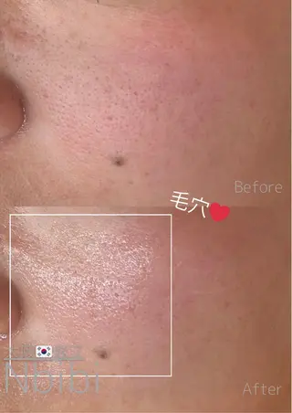 韓国🇰🇷価格 サロン_Nbibiの眉毛・アイブロウイメージ