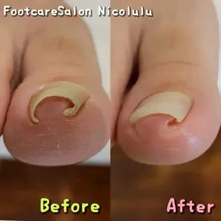 足トラブル専門 ニコルル金沢のエステ・リラクイメージ