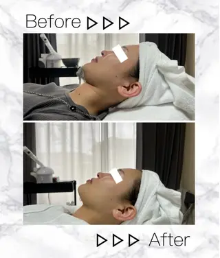 ROR Akariのエステ・リラクイメージ