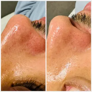 サロンur（ユア） Rieのエステ・リラクイメージ