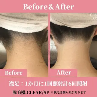 メンズ キッズ 有人型セルフサロン 脱毛／痩身／美顔のエステ・リラクイメージ