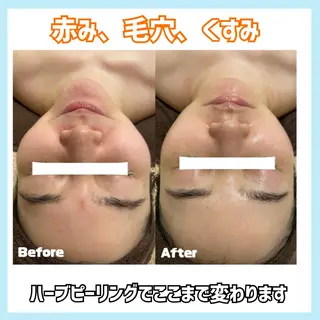 オールハンド専門🤍 痩身/小顔/ ハーブのエステ・リラクイメージ